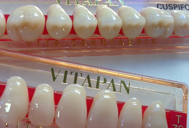 Soins dentaires : les prothèses dentaires seront-elles remboursées à 100% ?