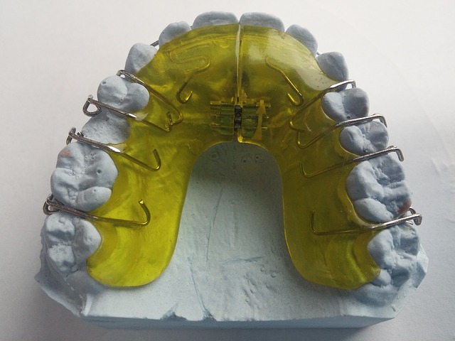 Quels remboursements pour l’orthodontie ?